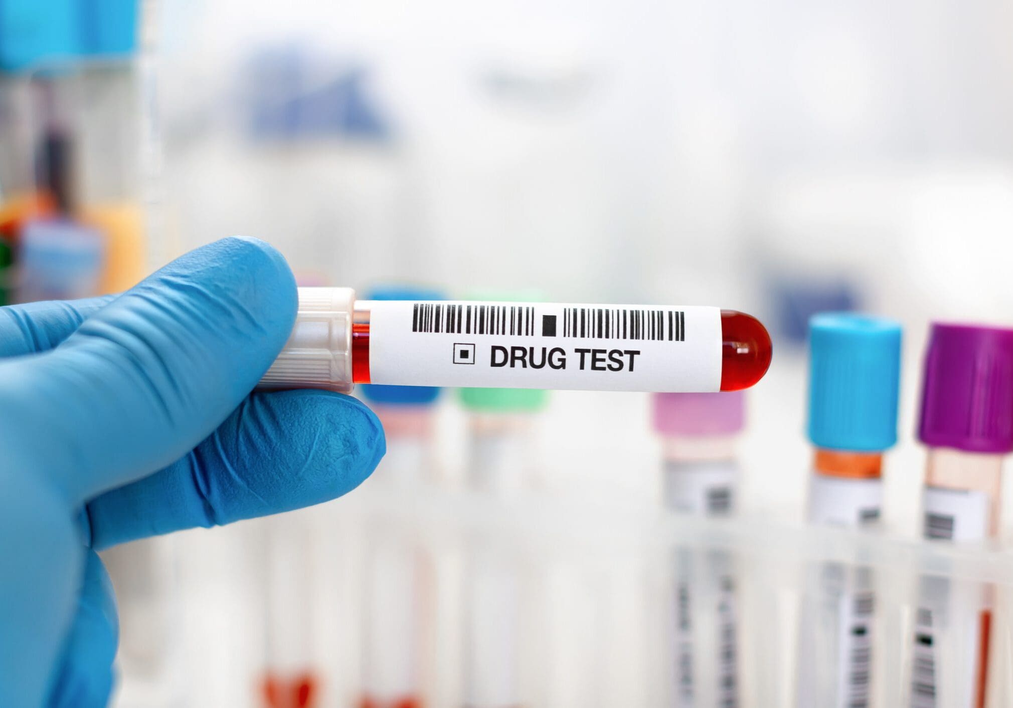 Gloved hand holding drug test vial